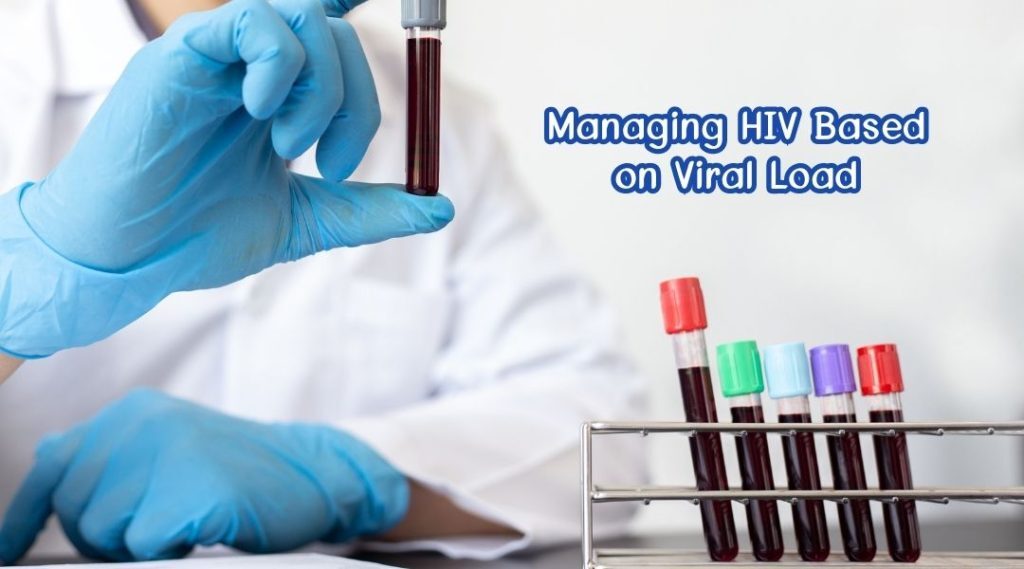 Managing HIV Based on Viral Load