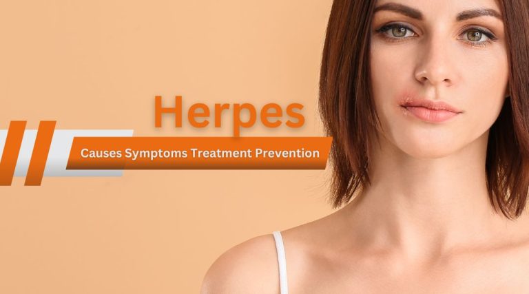 Herpes Causes Symptoms Treatment Prevention
